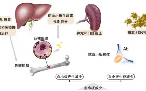 脾切除治疗血小板减少症效果怎么样？